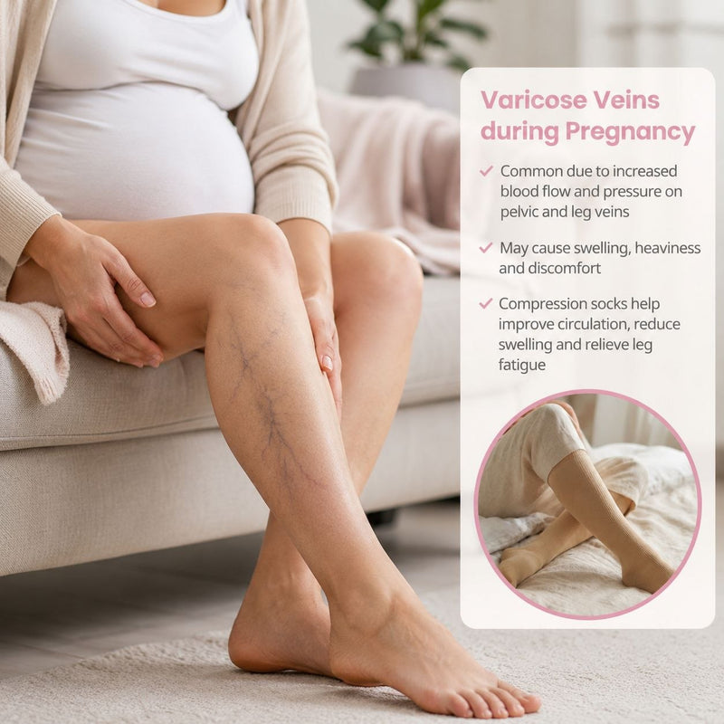 Varicose Veins & Vulvar Varicosities During Pregnancy: Causes, Relief & Prevention Tips