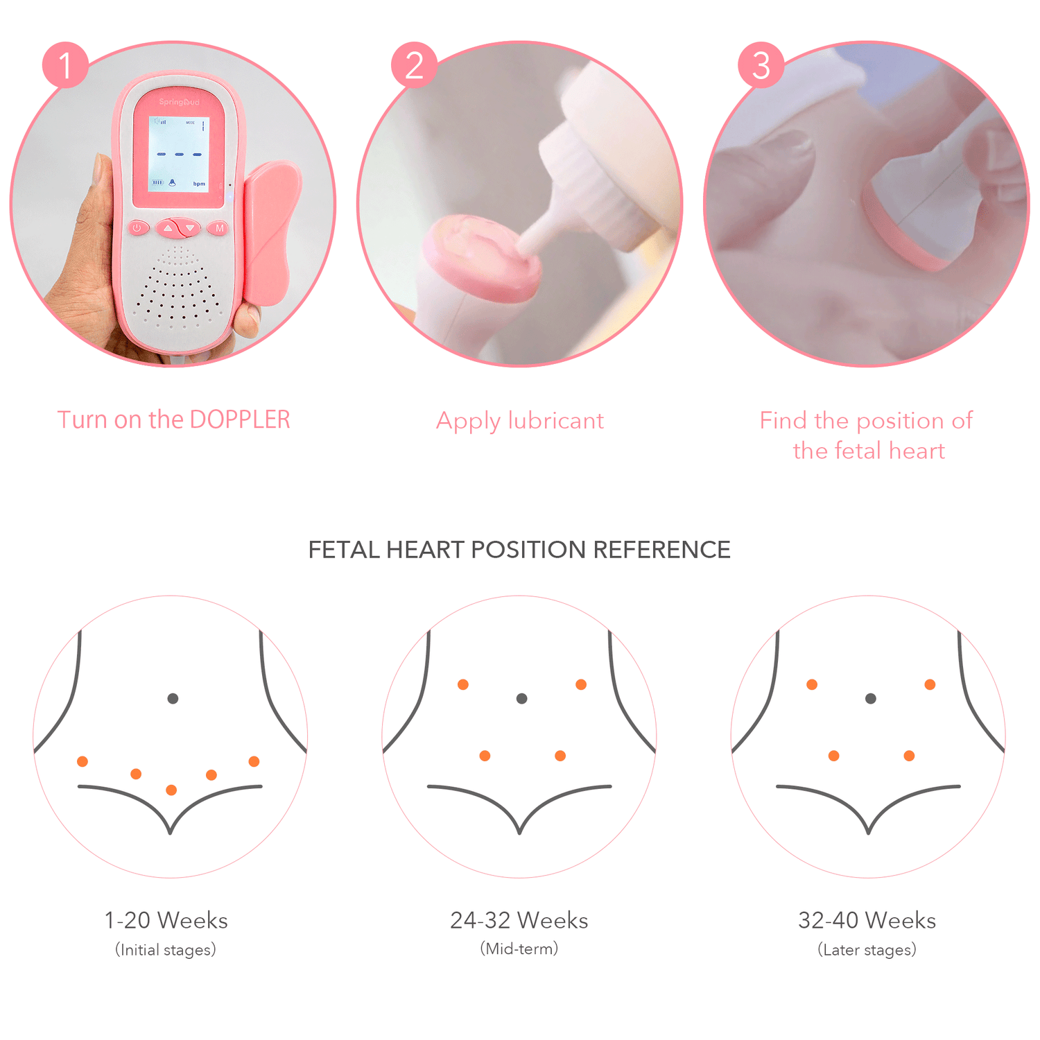 SpringBud FD-500B FDA Fetal Doppler